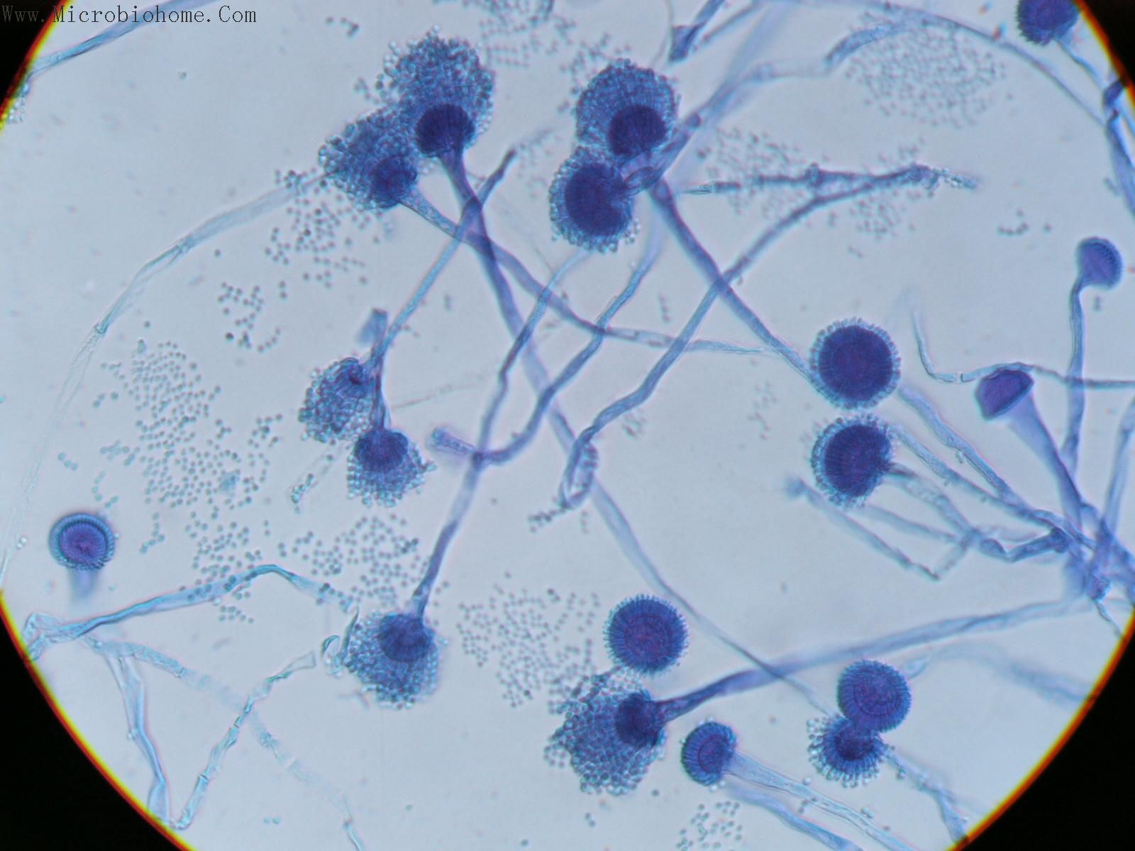 食品微生物学实验（细菌革兰氏染色及特殊结构染色） - 哔哩哔哩